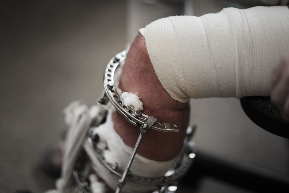 고통 속에서 글쓰기